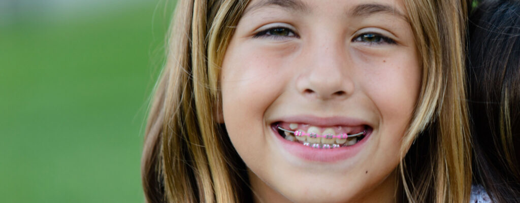 young girl smiles while undergoing phase 1 orthodontic treatment