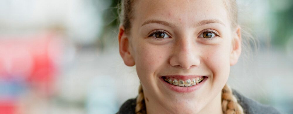 teens smiles after cleaning her teeth with braces