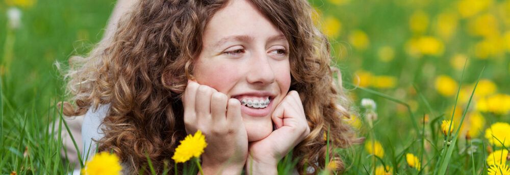 adult smiles revealing her fixed Gummy Smile